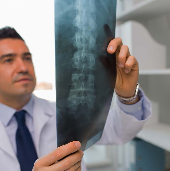 Doctor at Jupiter Disc Center examining patient x-rays for spine injury